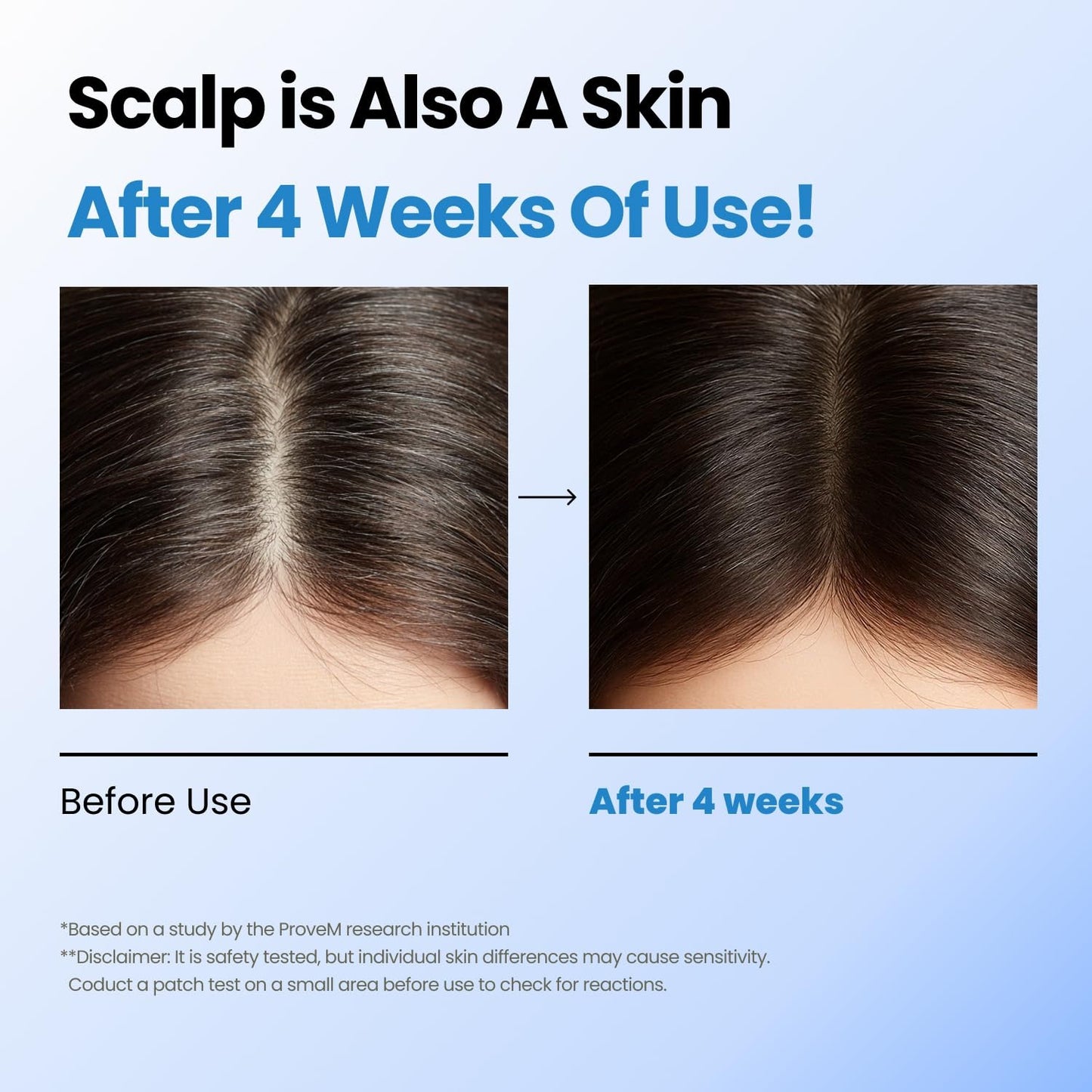 Seapuri Scalpy Hair Growth Serum For Men & Women For Hair Loss & Thinning - 20 ml
